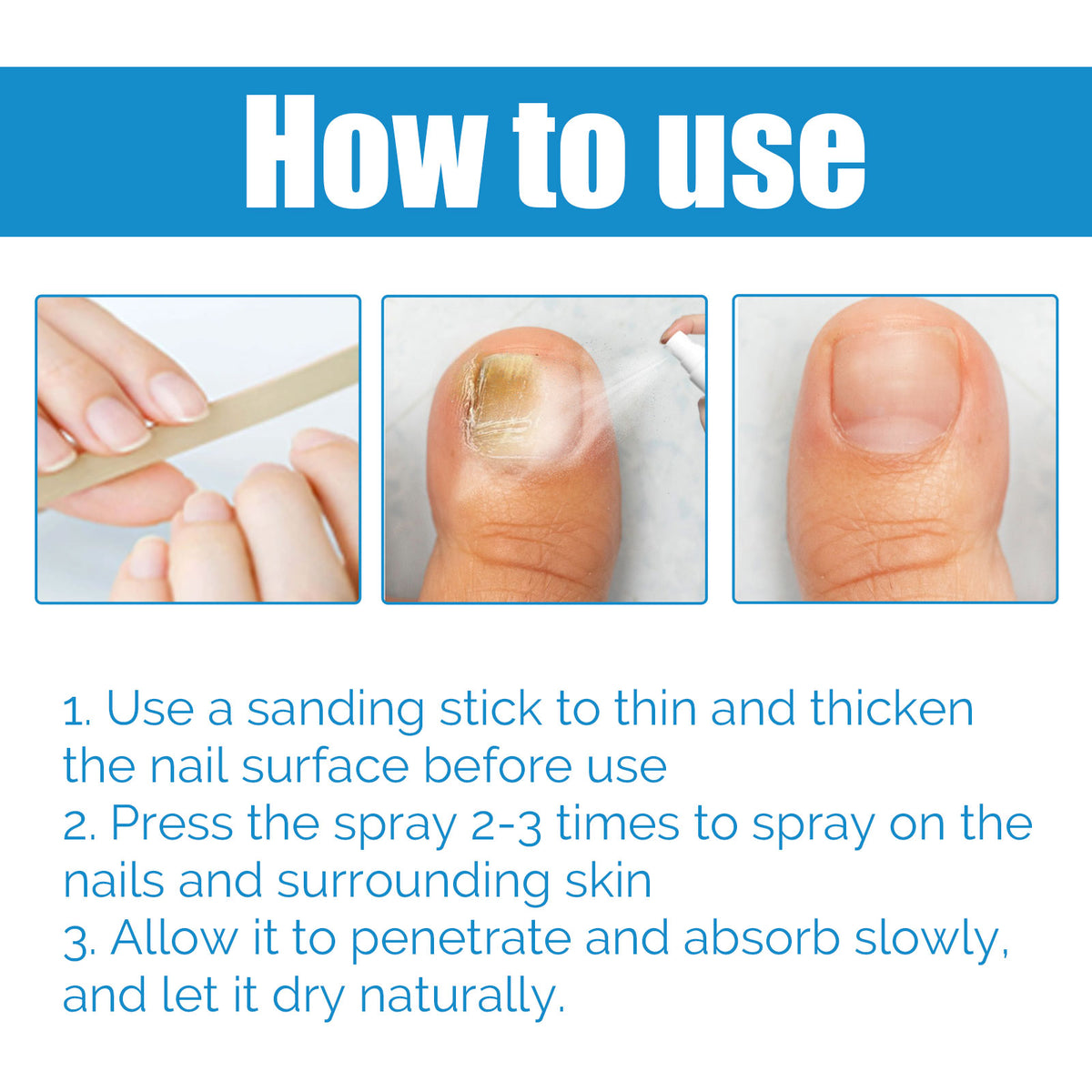 Anti-Fungal Disinfectant Nail Fungus Removal, Hand And Foot Gray Nails Clean Repair Soft Nails Thicken Nails Shine Nails Spray