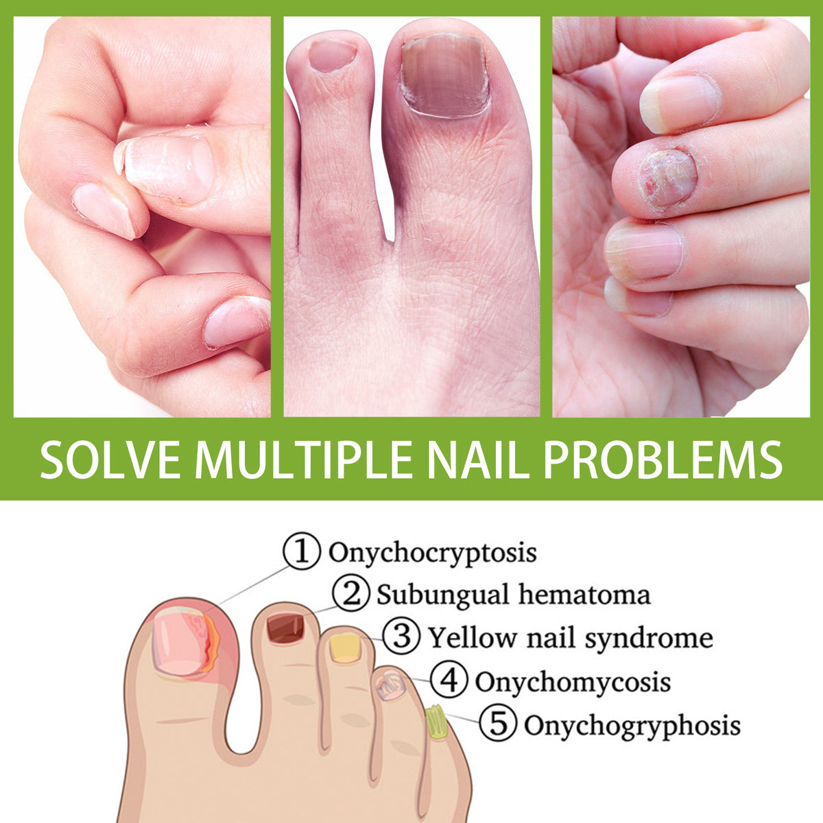 Anti-fungal Foot Soak, Foot Gray Nail Repair Bright Nail Deodorizer Foot Care Foam Tablets