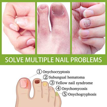 Anti-fungal Foot Soak, Foot Gray Nail Repair Bright Nail Deodorizer Foot Care Foam Tablets