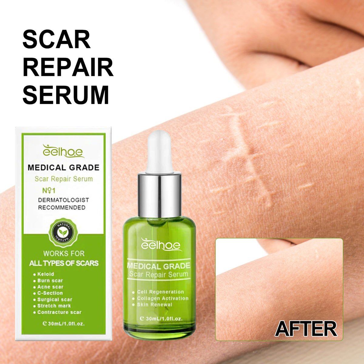Scar Repair Serum Reduces Scar Acne Mark Pregnancy Surgery Scar Repair Smooth Skin Care