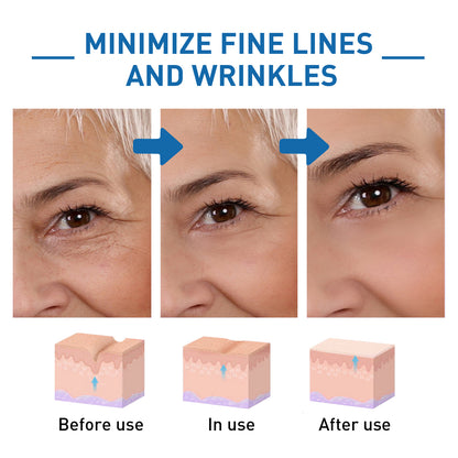 Hyaluronic Acid Anti-Wrinkle Essence, Reduces Lines Moisturizes Rejuvenates And Firms Skin Essence