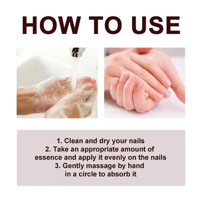 Therapy Vitamin E Serum, Hand And Foot Nail Repair Bright Nail Grey Nail Soft Nail Embedded Nail Care Essence