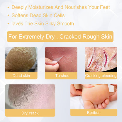 Foot Exfoliating Spray, Repair Brightening Remove Dead Skin Calluses Foot Whitening Care Spray