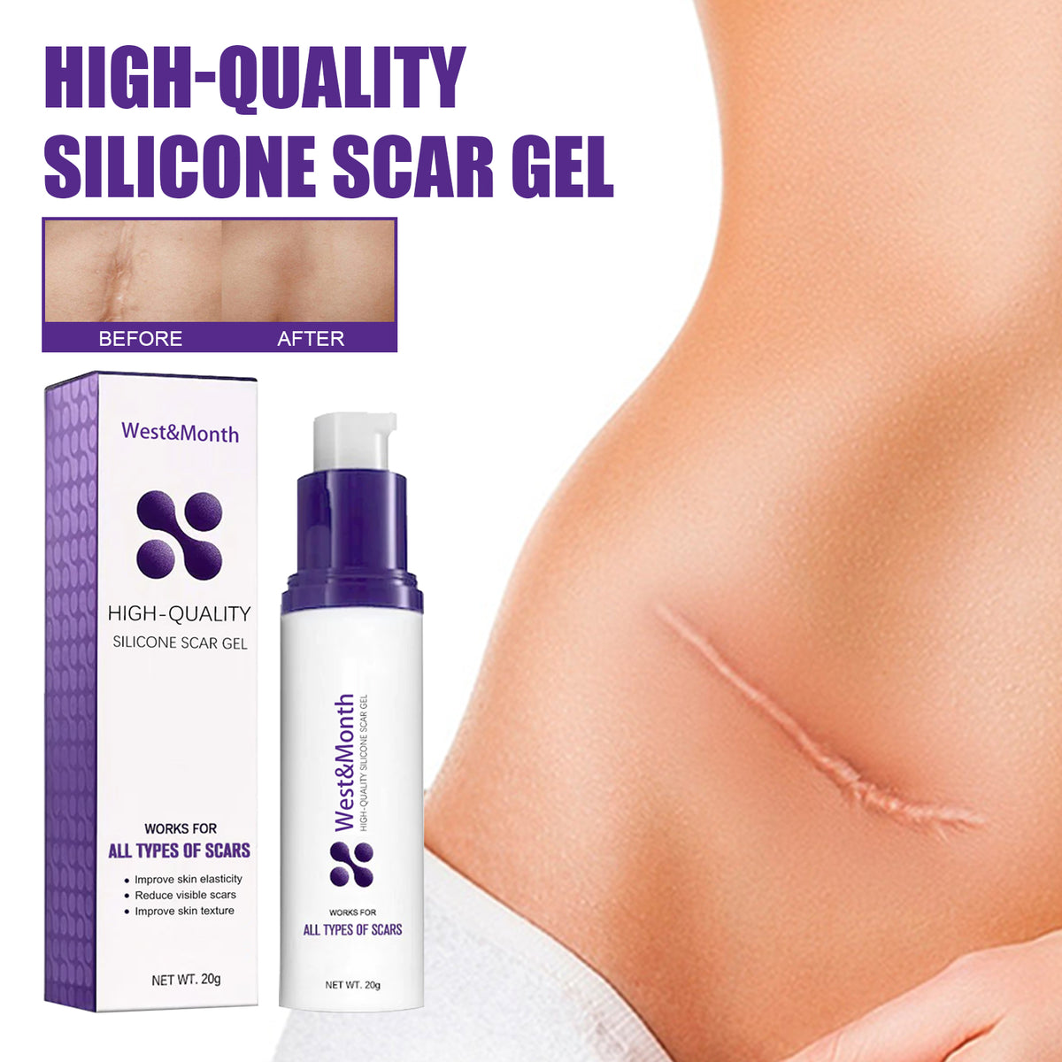High-quality Silicone Scar Gel, Lighten Acne Mark Scar Repair Skin Smoothing Care Cream