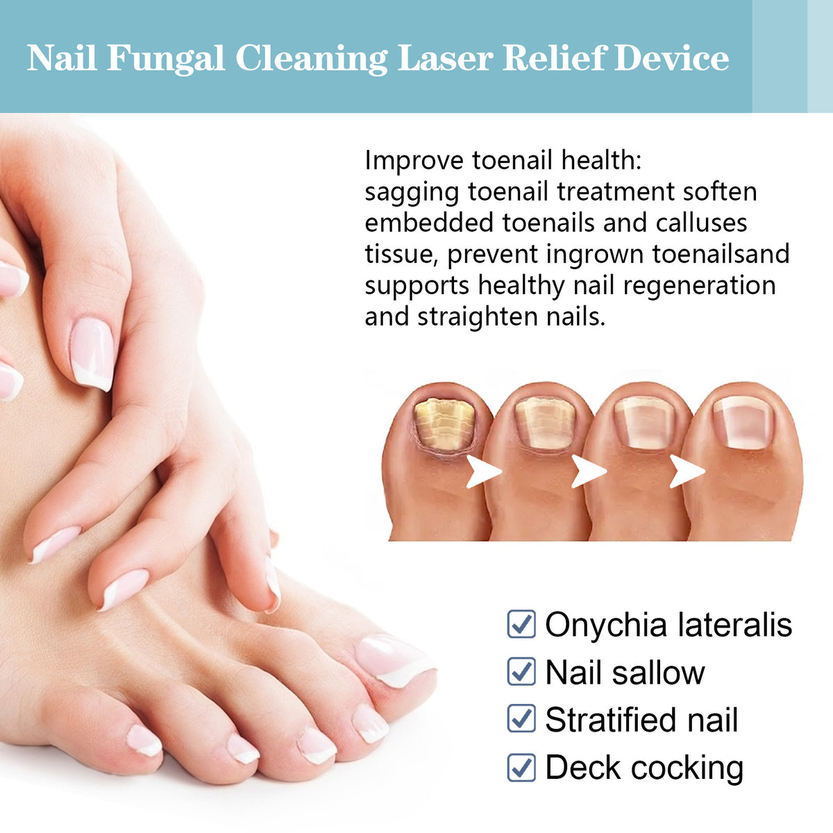 Nail Fungal Cleaning Laser Relief Device, Gray Nail Bad Nail Thickening Soft Nail Bright Nail Care Instrument