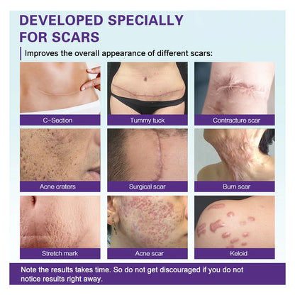 High-quality Silicone Scar Gel, Lighten Acne Mark Scar Repair Skin Smoothing Care Cream