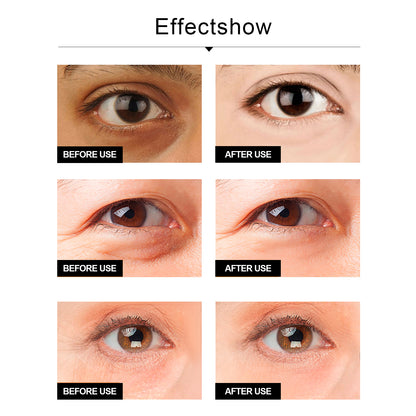 Snake Venom Eye Cream, Firming Eye Bags Hydrating And Reducing Fine Lines Eye Care Eye Cream