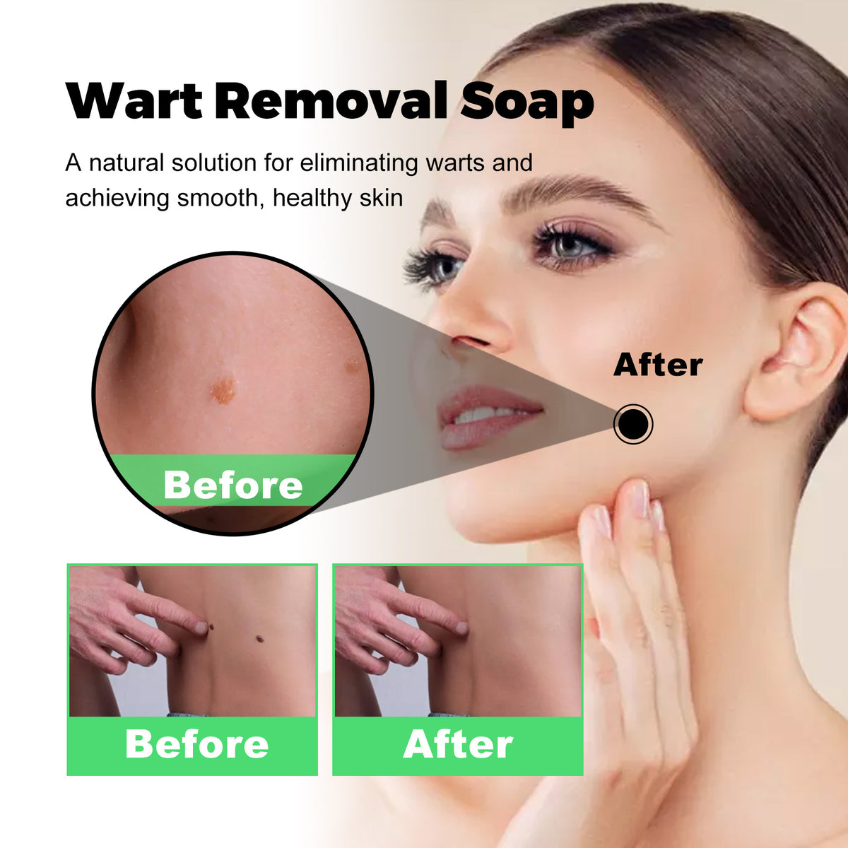 Skin Tag Removal Rubber Band, Remove Moles Remove Warts Face Neck Flesh Granule Body Cleansing Soap
