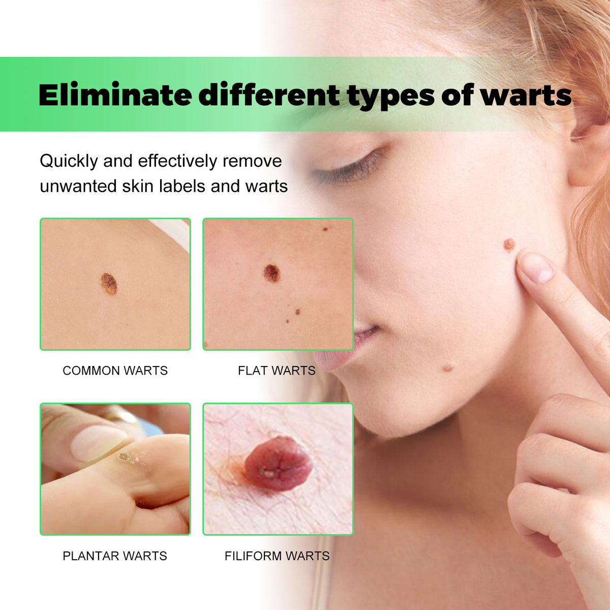 Skin Tag Removal Rubber Band, Remove Moles Remove Warts Face Neck Flesh Granule Body Cleansing Soap