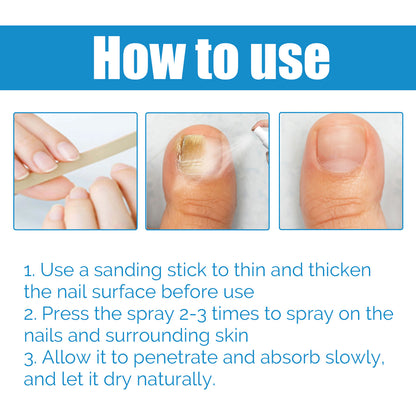 Anti-Fungal Disinfectant Nail Fungus Removal, Hand And Foot Gray Nails Clean Repair Soft Nails Thicken Nails Shine Nails Spray