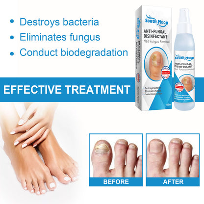Anti-Fungal Disinfectant Nail Fungus Removal, Hand And Foot Gray Nails Clean Repair Soft Nails Thicken Nails Shine Nails Spray