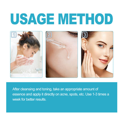 Salicylic Acid Exfoliating Essence, Deep Clean Skin Pores Exfoliate And Moisturize Essence