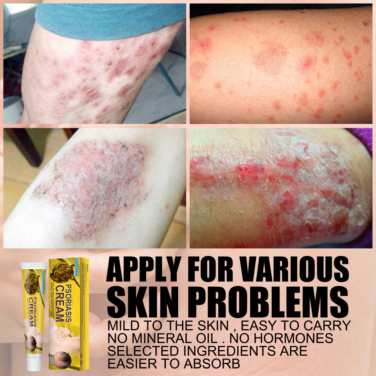 Skin Care Cream Body Skin Moisturizing Repair Topical Application Ointment Skin Cream