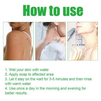 Mole Remover Soap, Repair Meat Granules Corns And Dark Moles, Smooth Skin Anti-wart Cleansing Soap