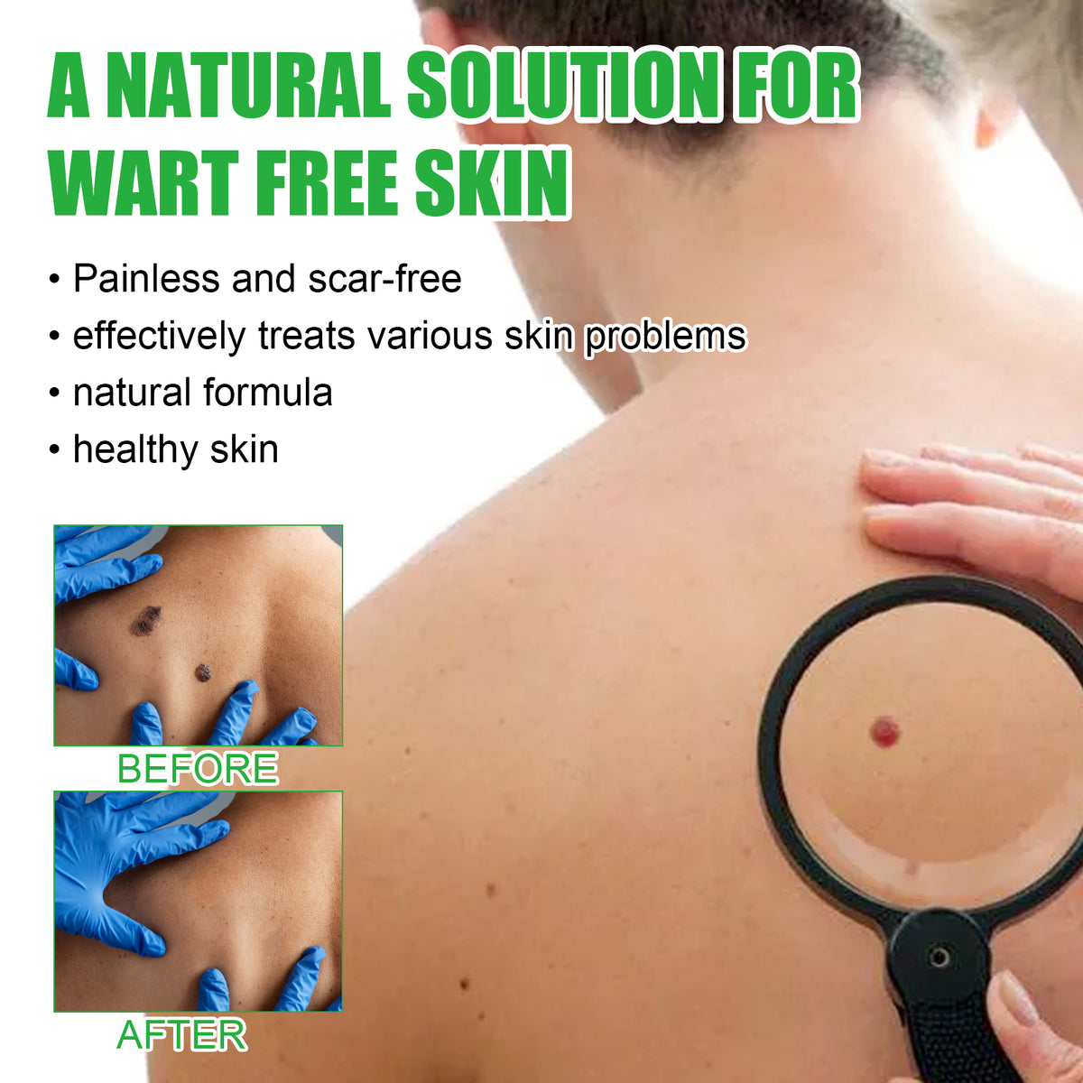 Mole Remover Soap, Repair Meat Granules Corns And Dark Moles, Smooth Skin Anti-wart Cleansing Soap