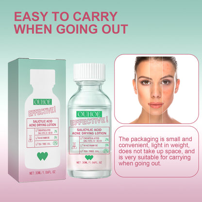 Salicylic Acid Acne Drying Lotion, Gentle Repair Acne-Skin Skin Moisturizing Lotion