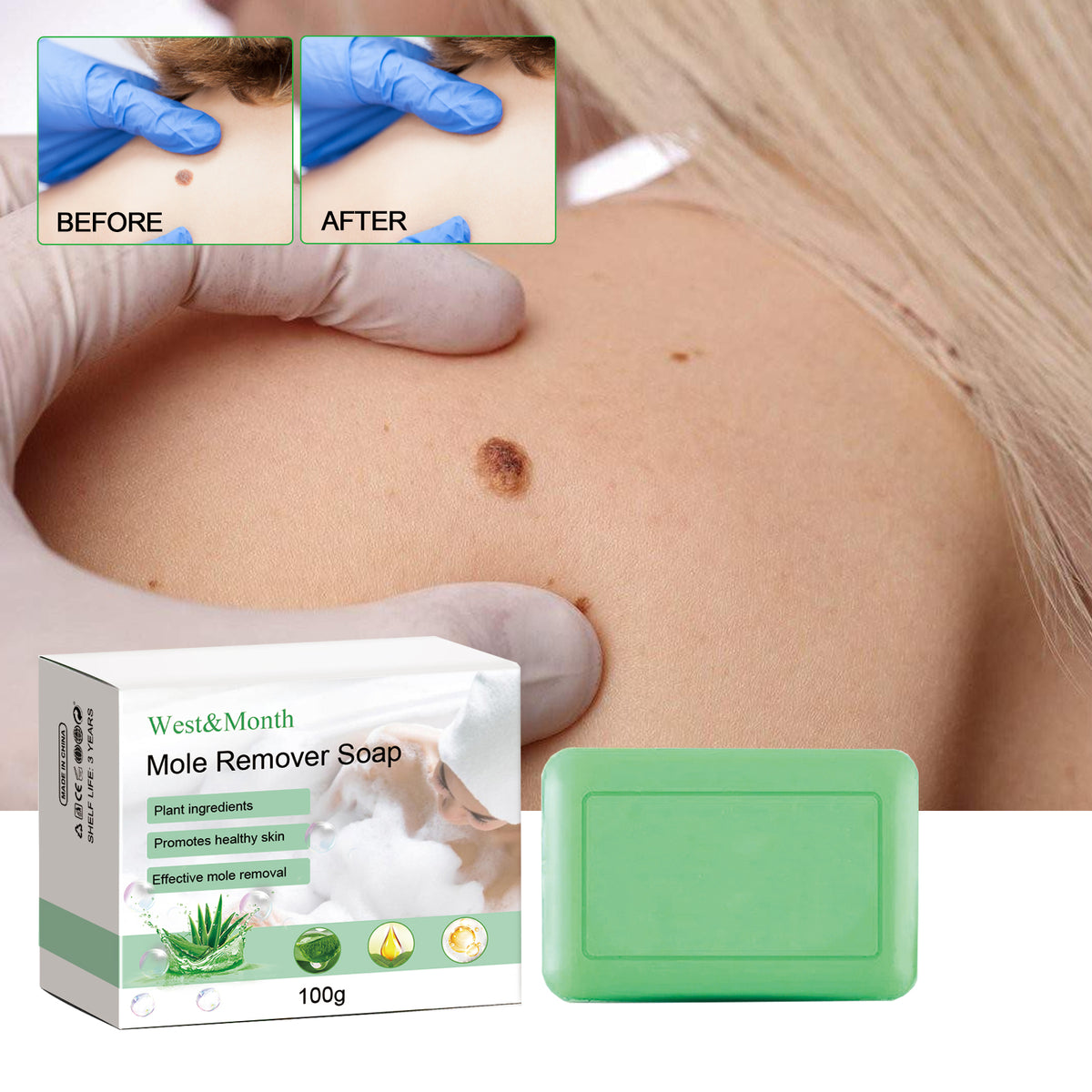 Mole Remover Soap, Repair Meat Granules Corns And Dark Moles, Smooth Skin Anti-wart Cleansing Soap