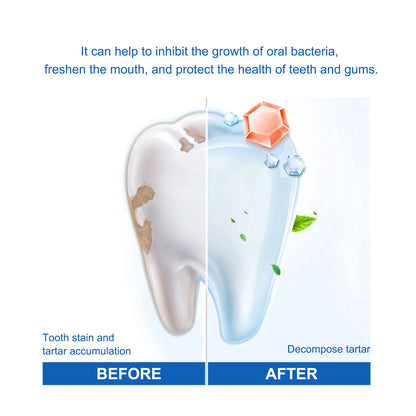 Teeth Whitening Serum, Removing Plaque Smoke Stain Bad Breath Teeth And Oral Cleaning Care Serum