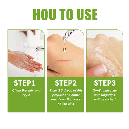 Scar Repair Serum Reduces Scar Acne Mark Pregnancy Surgery Scar Repair Smooth Skin Care