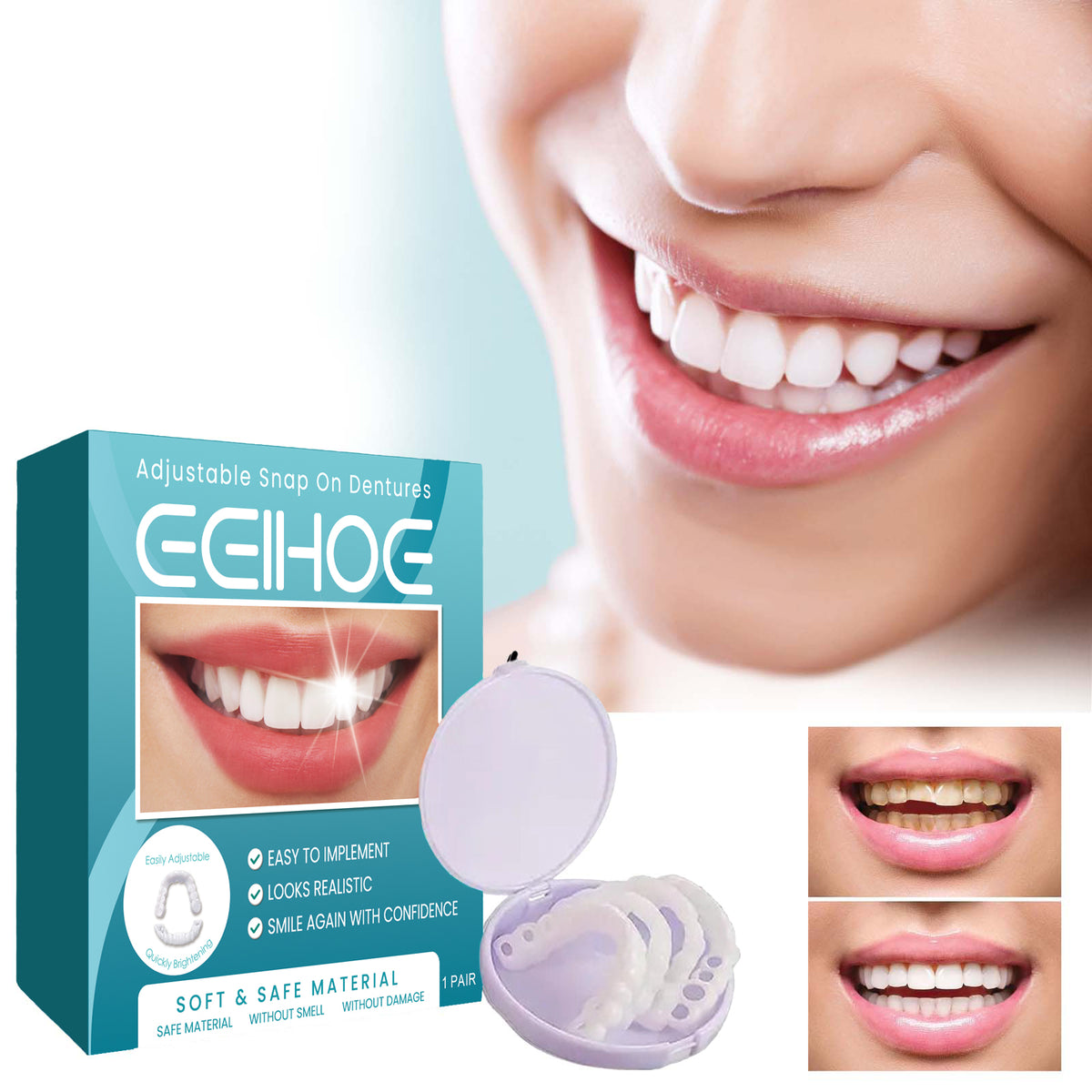 Adjustable Buckle Denture, Temporary Fillings Interdental Fillings Orthodontic Denture Kits