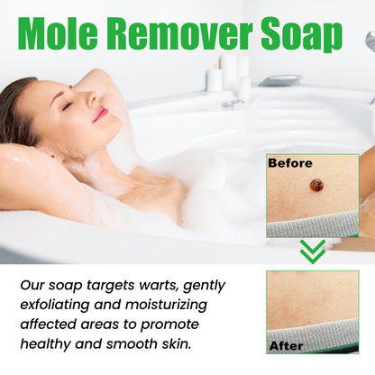 Mole Remover Soap, Repair Meat Granules Corns And Dark Moles, Smooth Skin Anti-wart Cleansing Soap