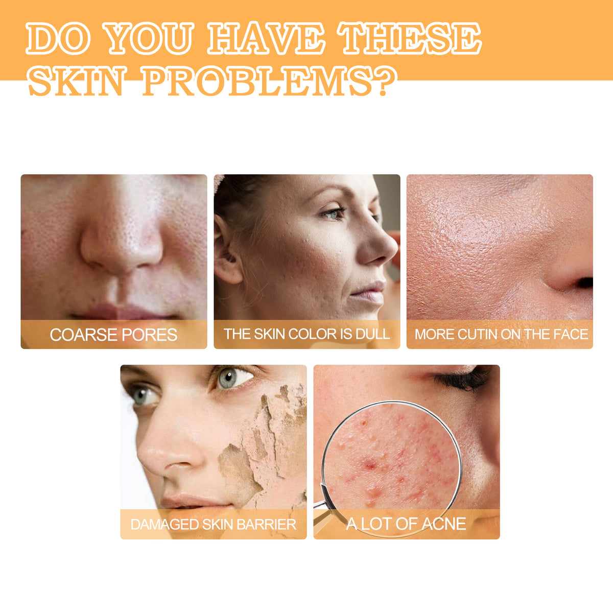 Glycolic Acid 7% Toner, Remove Acne Lighten Acne Repair Acne Mark Moisturize Skin Toner