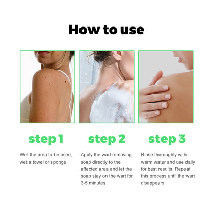 Skin Tag Removal Rubber Band, Remove Moles Remove Warts Face Neck Flesh Granule Body Cleansing Soap