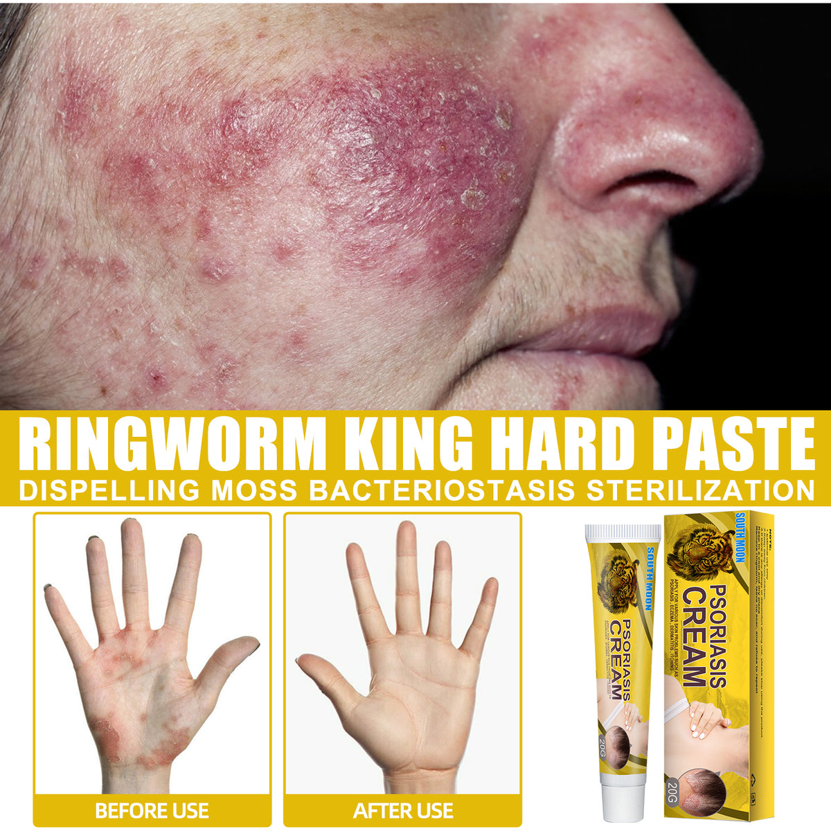Skin Care Cream Body Skin Moisturizing Repair Topical Application Ointment Skin Cream