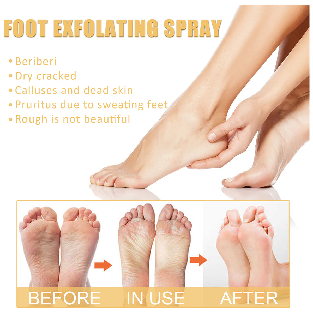 Foot Exfoliating Spray, Repair Brightening Remove Dead Skin Calluses Foot Whitening Care Spray