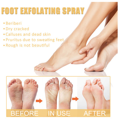 Foot Exfoliating Spray, Repair Brightening Remove Dead Skin Calluses Foot Whitening Care Spray