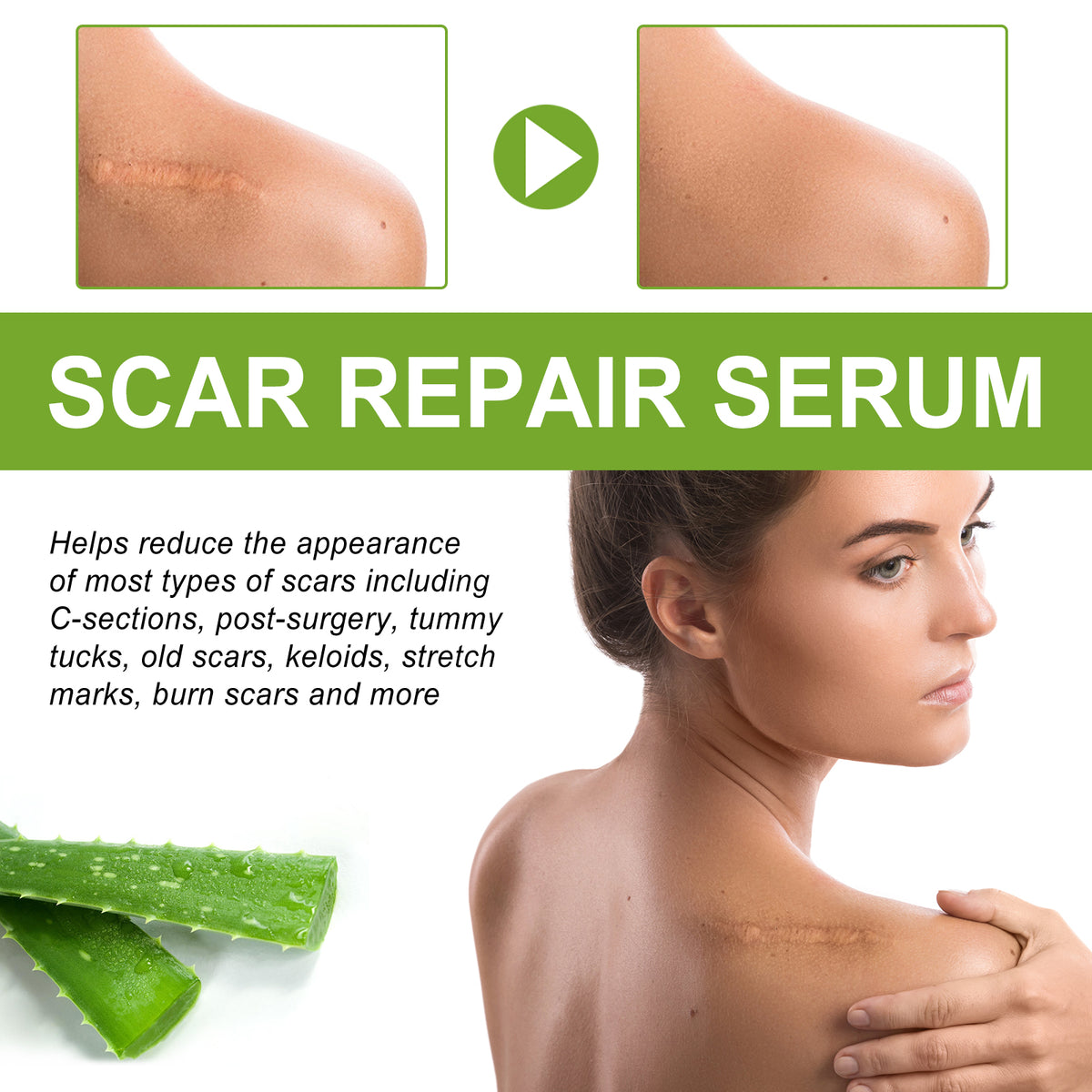 Scar Repair Serum Reduces Scar Acne Mark Pregnancy Surgery Scar Repair Smooth Skin Care